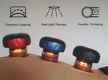 Restore Cupping Device