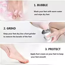 Vacuum Callus Remover